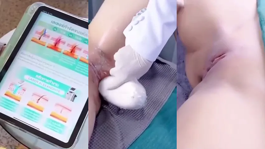 คลิปหลุด รีวิวการเลเซอร์ขนจิมิ ที่เป็นข่าว